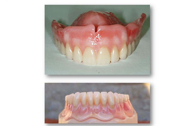 Image of Maidstone Denture Studio - Upper and Lower Complete Dentures