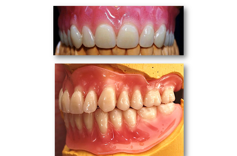 Image of Maidstone Denture Studio - Wax Complete Dentures